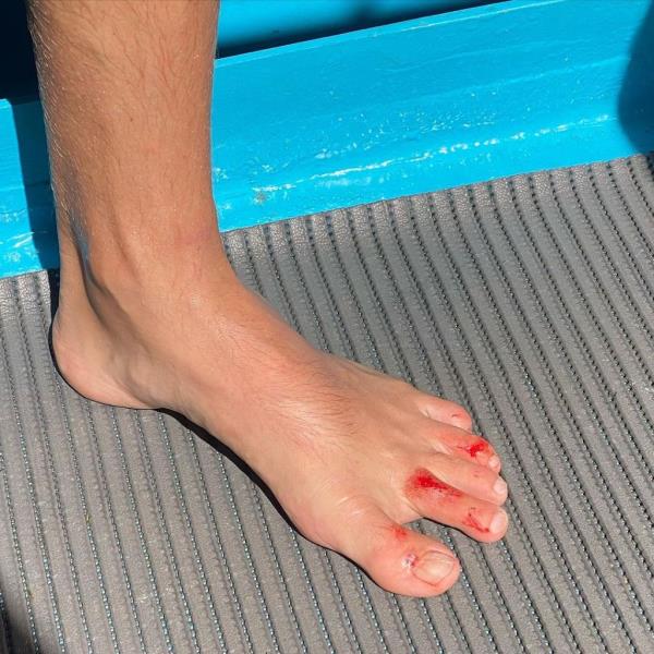 Colin Jost's foot