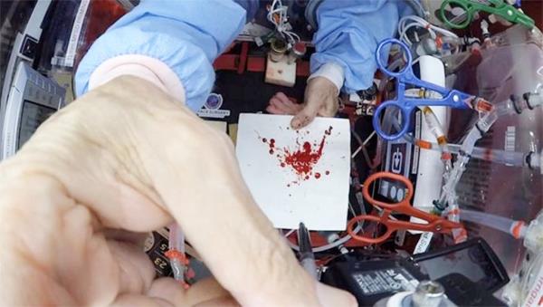 The tests showed different ways blood appears in zero gravity.