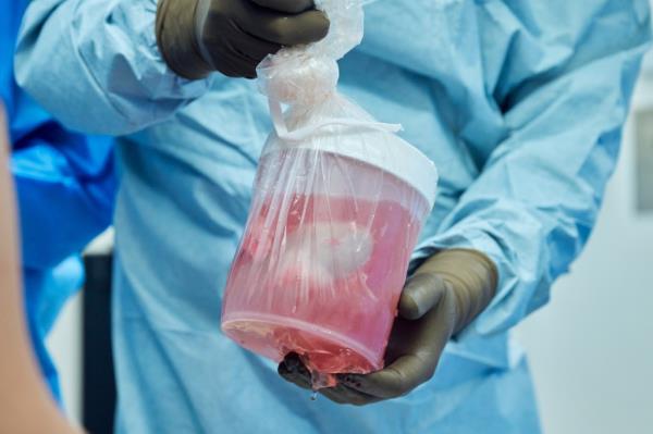 Pig kidneys transplants could one day become a life saving medical procedure, the team at NYU says.