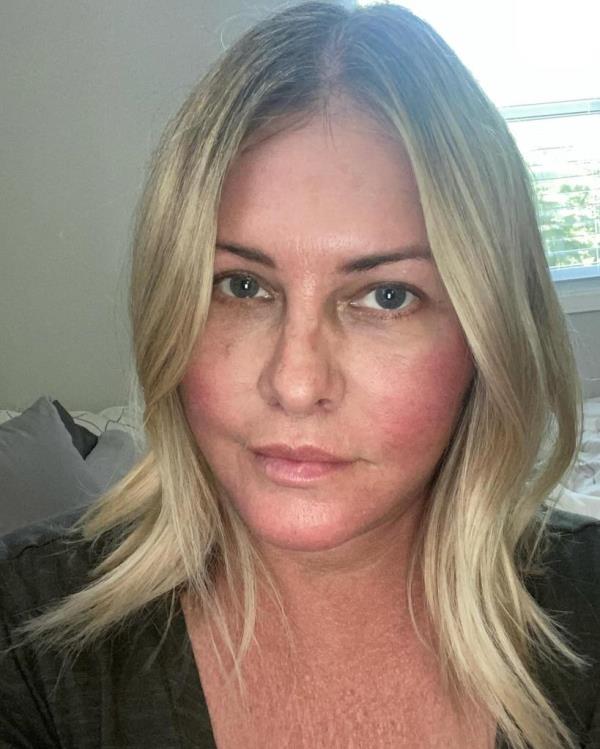 Baywatch' star Nicole Eggert reveals more cancer has been found in her lymph nodes